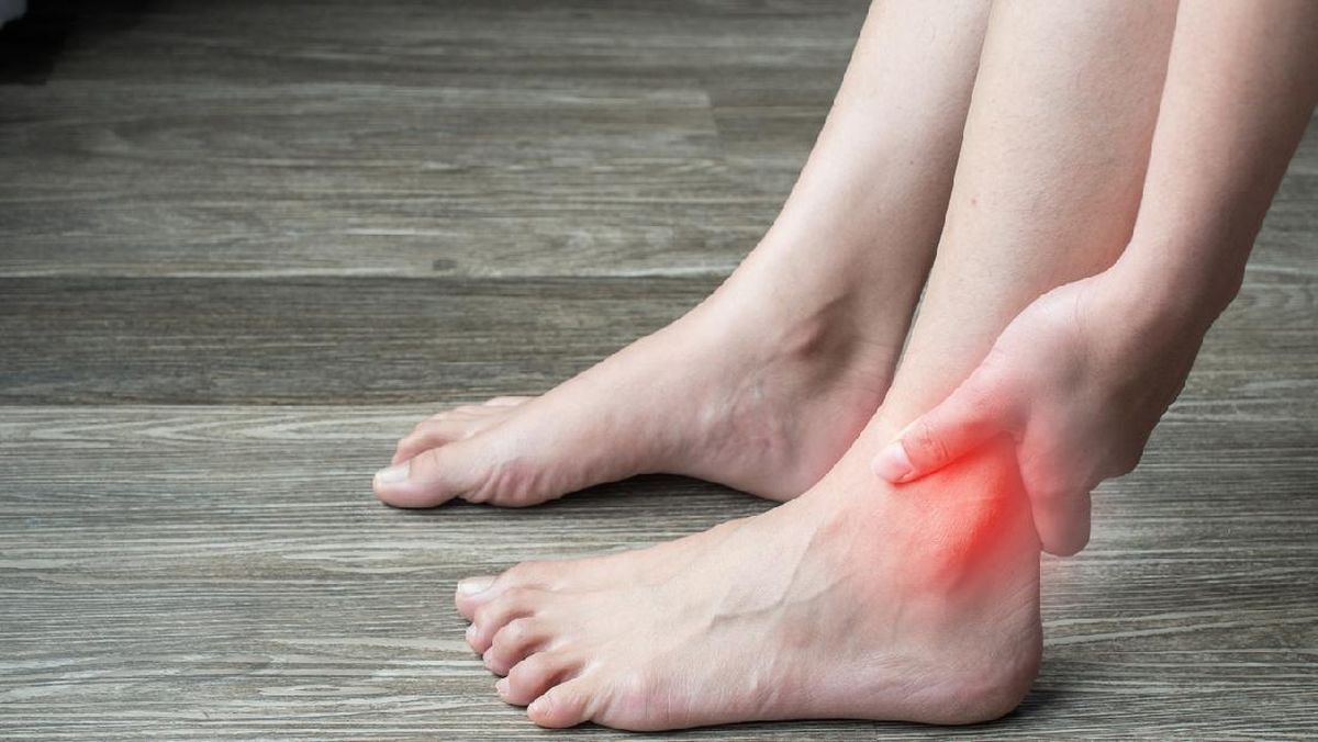 Atasi Masalah Asam Urat,  Lakukan ini ….